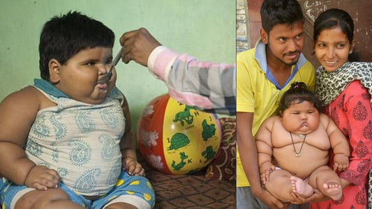 Family Struggles To Feed 53-Pound Baby