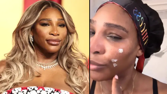 Serena Williams Sets the Record Straight on Skin Bleaching Rumors: 'Ridiculous and Untrue'